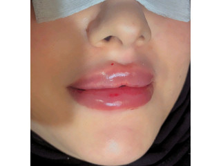 فرصة استثمارية عظيمة