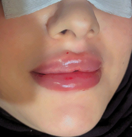 frs-astthmary-aathym-big-0